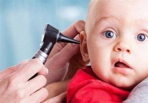 بیش از ۱۵ هزار نوزاد در البرز شنوایی سنجی شدند