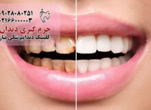 مراقبت‌های دندانپزشکی که باید قبل از ۴۰ سالگی انجام دهید