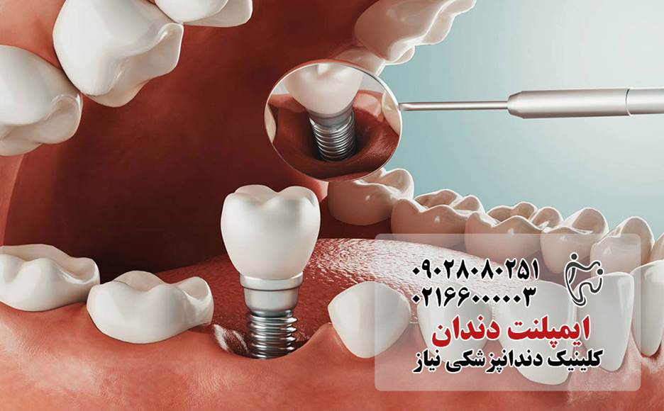 مراقبت‌های دندانپزشکی که باید قبل از ۴۰ سالگی انجام دهید