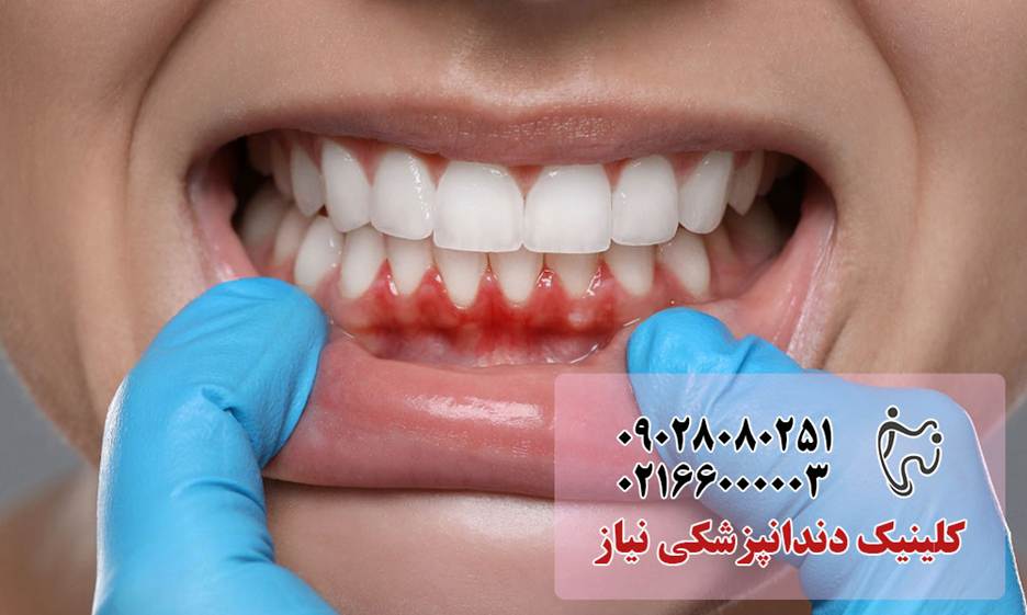 مراقبت‌های دندانپزشکی که باید قبل از ۴۰ سالگی انجام دهید