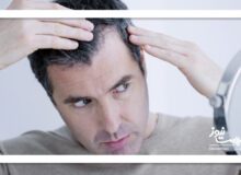 راز موهای سالم با طب ایرانی؛ درمانی طبیعی، ارزان و مؤثر