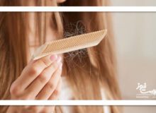 ۵ روش برای کاهش ریزش مو بدون دارو یا مکمل