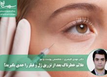 علائم خطرناک بعد از تزریق ژل و فیلر را جدی بگیرید!