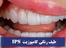 طیف رنگی کامپوزیت IPS : رنگ BLXL و رنگ bll