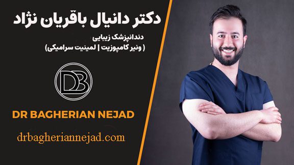 قبل از مراجعه به دندانپزشک زیبایی در اصفهان، این ۵ نکته را از دست ندهید!