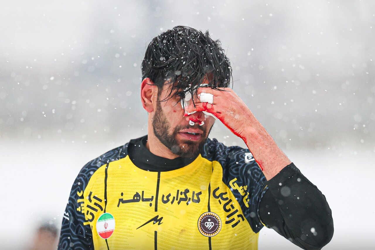 عکس | وقتی مهاجم سپاهان غرق در خون شد!