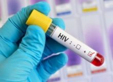 آگاهی و تبعیت درمان کلید طول عمر طبیعی مبتلایان HIV