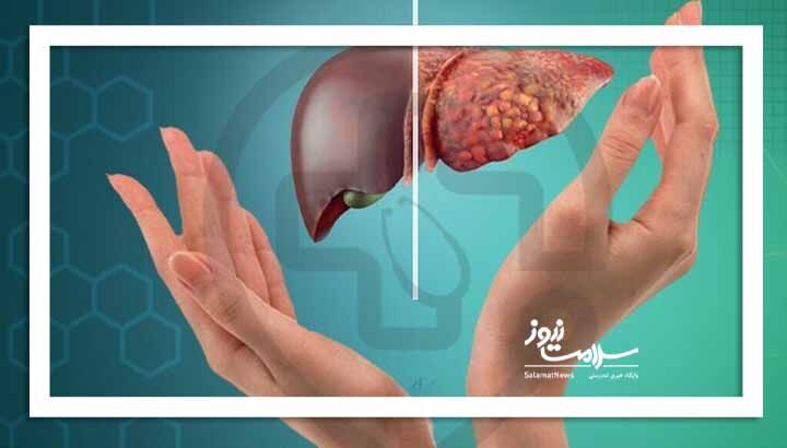 نسخه جادویی طب ایرانی برای حفاظت از کبد و کلیه