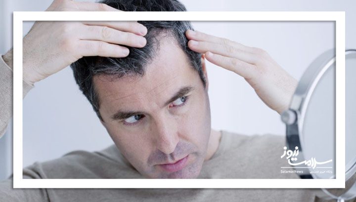 راز موهای سالم با طب ایرانی؛ درمانی طبیعی، ارزان و مؤثر
