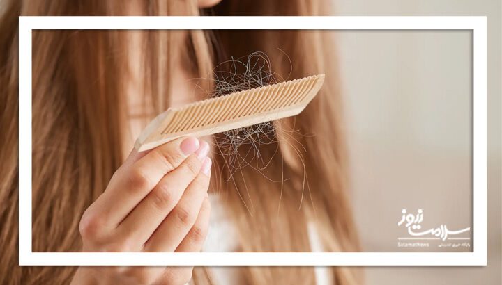 ۵ روش برای کاهش ریزش مو بدون دارو یا مکمل