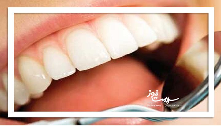 لبخند تقلبی به قیمت سلامت دندان