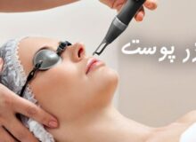 چگونه با لیزر پوست ۱۰ سال جوان تر به نظر برسیم ؟