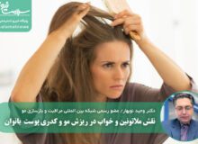 نقش ملاتونین و خواب در ریزش مو و کدری پوست  بانوان