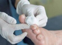 ارائه خدمات رایگان پلاسما درمانی به بیماران دیابتی در کرج